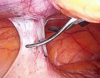 Описание: http://www.tiensmed.ru/news/uimg_new/19/spaiki16-1299394531.jpg